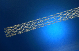 Fibre and Wire Based Stents and Impantable Structures